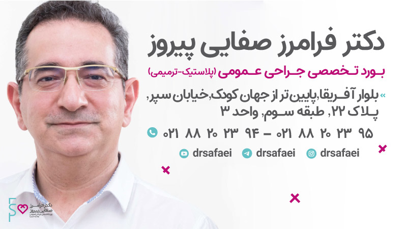 دکتر صفایی | بوتاکس و خشکی چشم